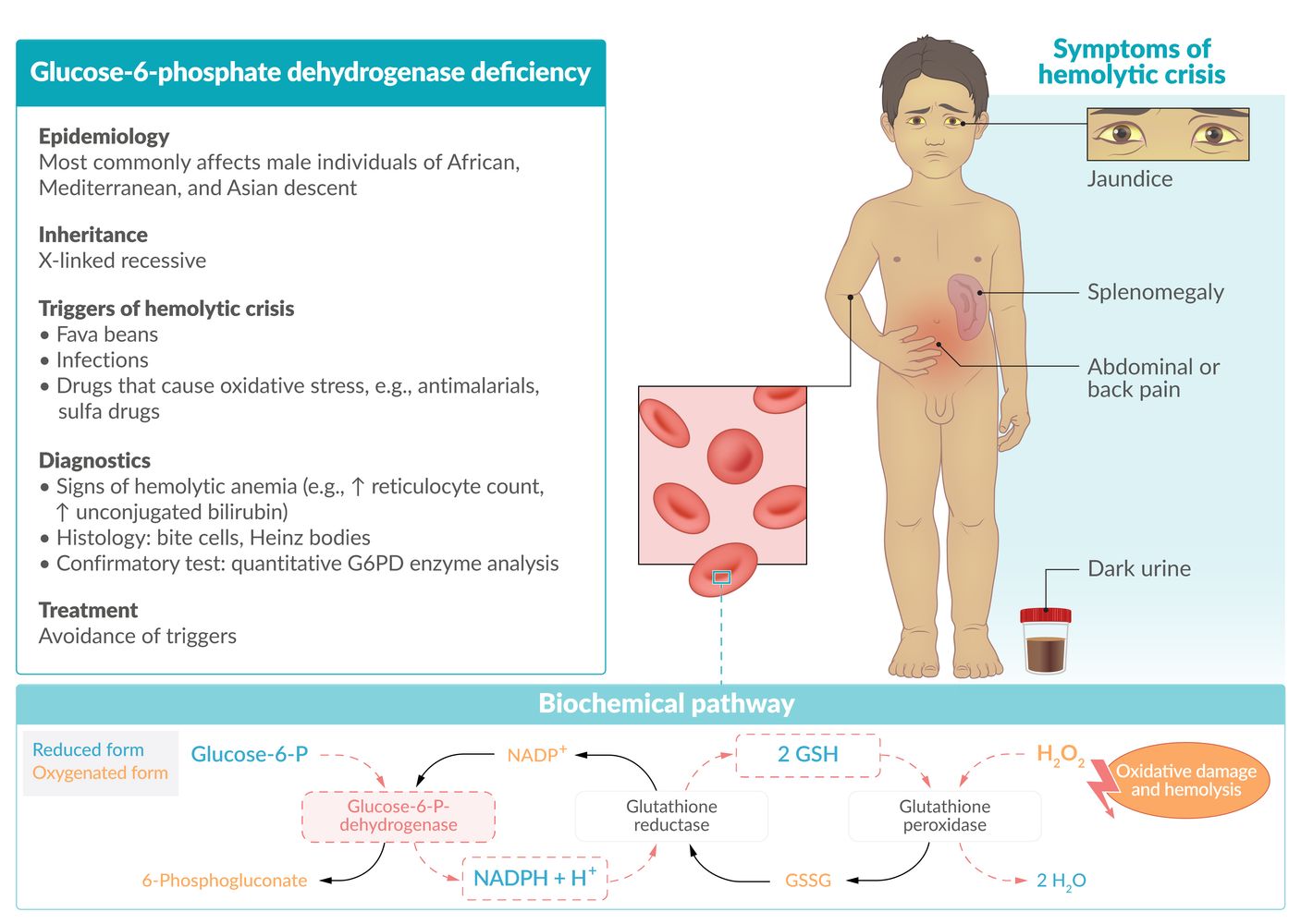 G6pd Deficiency
