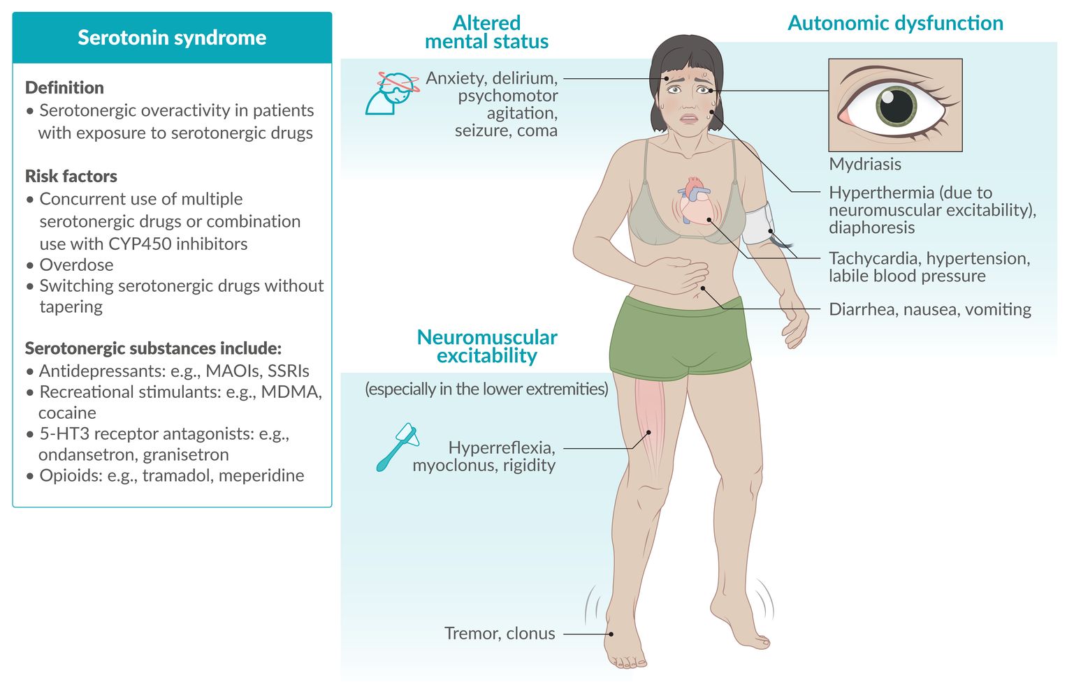 Serotonin syndrome