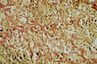 Pathology techniques - Knowledge @ AMBOSS