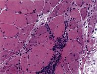 Pathology techniques - Knowledge @ AMBOSS