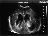 Congenital TORCH infections - Knowledge @ AMBOSS