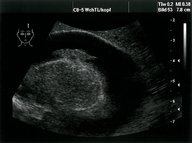 Congenital TORCH infections - Knowledge @ AMBOSS