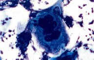 Pathology techniques - Knowledge @ AMBOSS