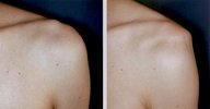 Orthopedic shoulder examination - Knowledge @ AMBOSS