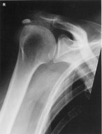 Basic calcium phosphate crystal deposition diseases - Knowledge @ AMBOSS