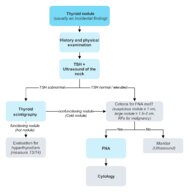 Thyroid nodules - Knowledge @ AMBOSS