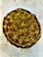 Helminth infections - Knowledge @ AMBOSS