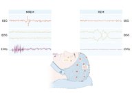Neurophysiological diagnostics - Knowledge @ AMBOSS