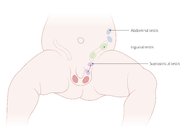 Scrotal abnormalities - Knowledge @ AMBOSS