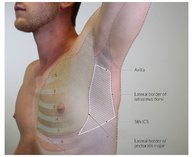 Pneumothorax - Knowledge @ AMBOSS