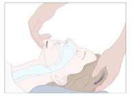 Airway management - Knowledge @ AMBOSS