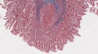 Gastrointestinal tract - Knowledge @ AMBOSS