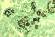 Pathology techniques - Knowledge @ AMBOSS