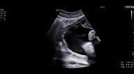 Point-of-care ultrasound - Knowledge @ AMBOSS
