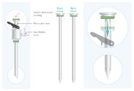 Laparoscopic surgery - Knowledge @ AMBOSS