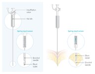 Laparoscopic surgery - Knowledge @ AMBOSS