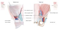 Inguinal hernia - Knowledge @ AMBOSS