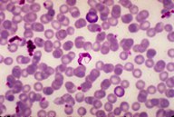 Pathology techniques - Knowledge @ AMBOSS