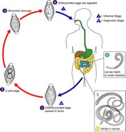 Helminth infections - Knowledge @ AMBOSS