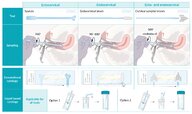 Cervical cancer screening - Knowledge @ AMBOSS