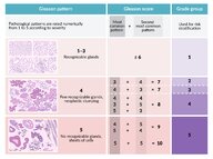 Prostate cancer - Knowledge @ AMBOSS