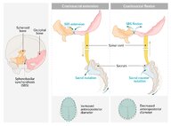 Cranial osteopathy<!-- --> - <!-- -->Knowledge<!-- --> @ AMBOSS