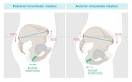 Pelvic and sacral osteopathy - Knowledge @ AMBOSS