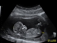 Point-of-care ultrasound - Knowledge @ AMBOSS
