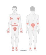 Scabies - Knowledge @ AMBOSS