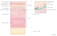 Cutaneous squamous cell carcinoma - Knowledge @ AMBOSS