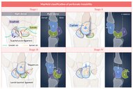 Carpal ligament injuries - Knowledge @ AMBOSS