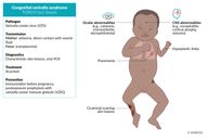 Congenital TORCH infections - Knowledge @ AMBOSS