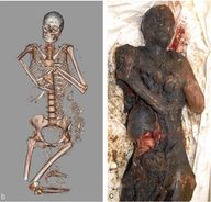 Forensic traumatology - Knowledge @ AMBOSS