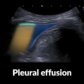 Point-of-care ultrasound - Knowledge @ AMBOSS